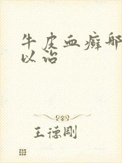 牛皮血癣哪里可以治