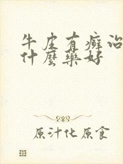 牛皮有癣治疗用什么药好