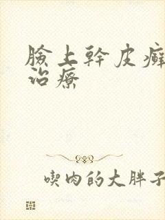 脸上干皮癣怎么治疗