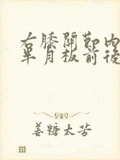 右膝关节内外侧半月板前后角2度损伤封面