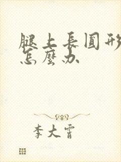 腿上长圆形的癣怎么办