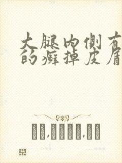 大腿内侧有白色的癣掉皮屑
