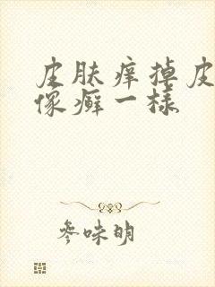 皮肤痒掉皮屑 像癣一样
