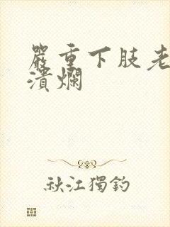 严重下肢老烂腿溃烂封面