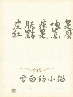 皮肤痒但是没有红点是怎么回事