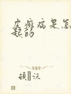 皮癣病是怎么引起的封面