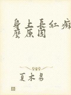 身上长红癣是什么原因