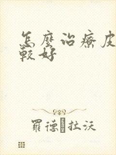 怎么治疗皮癣比较好