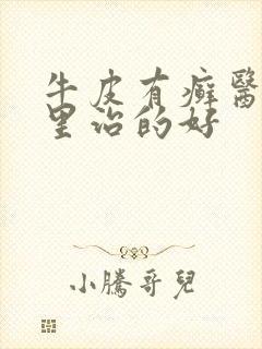 牛皮有癣医院哪里治的好