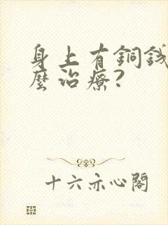身上有铜钱癣怎么治疗?