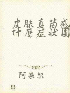 皮肤真菌感染是什么症状图片