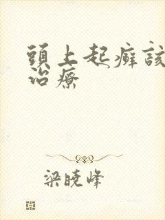 头上起癣该怎么治疗