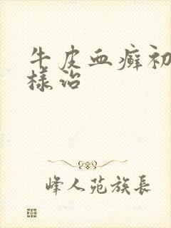 牛皮血癣初期怎样治