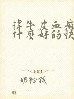 得牛皮血癣多吃什么好的快