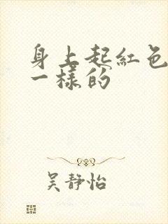 身上起红色像癣一样的