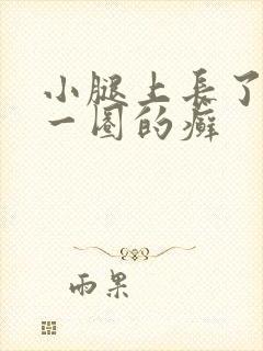小腿上长了红色一圈的癣