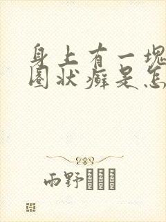 身上有一块块的圈状癣是怎么回事