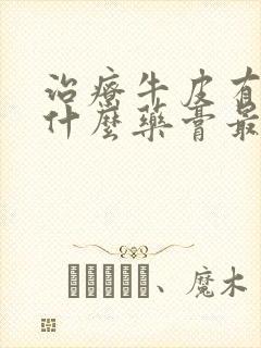 治疗牛皮有癣用什么药膏最好