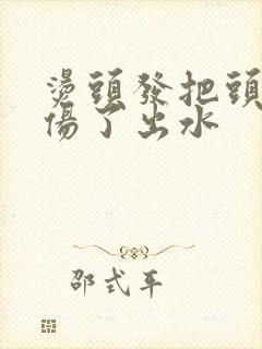烫头发把头皮烫伤了出水封面