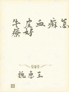 牛皮血癣怎么治疗好