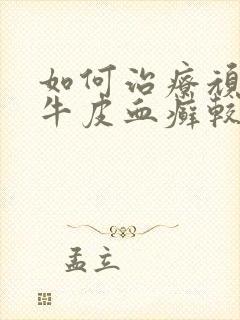 如何治疗顽固性牛皮血癣较好
