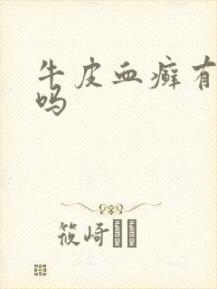牛皮血癣有的治吗
