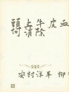 头上牛皮血癣如何消除