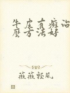 牛皮有癣治疗什么方法好