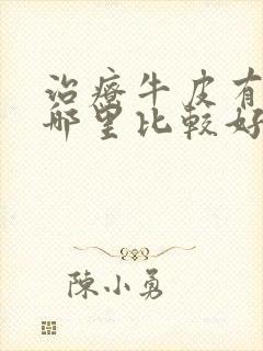 治疗牛皮有癣去哪里比较好