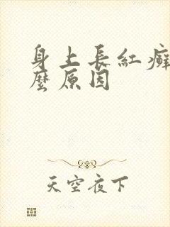 身上长红癣是什么原因