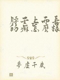 脖子上面长红色的癣怎么样