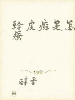 干皮癣是怎么治疗