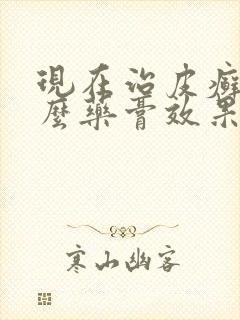 现在治皮癣用什么药膏效果好