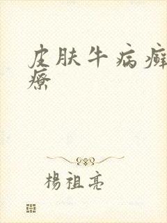 皮肤牛病癣的治疗