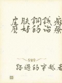 皮肤铜钱癣有什么好的治疗办法