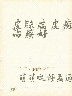 皮肤病皮癣怎么治疗好