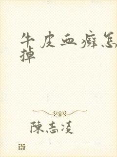 牛皮血癣怎样去掉