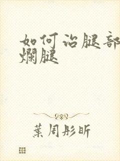 如何治腿部的老烂腿