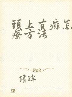 头上有癣怎么治疗方法