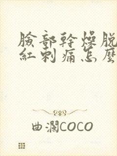 脸部干燥脱皮发红刺痛怎么恢复正常