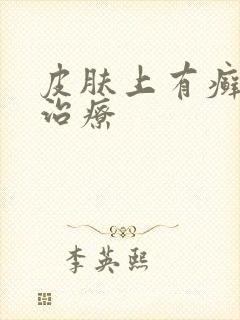 皮肤上有癣怎么治疗