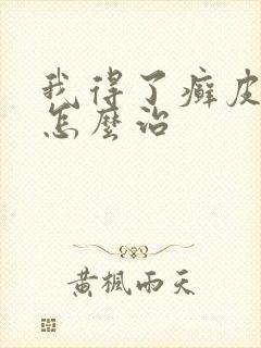 我得了癣皮肤病怎么治