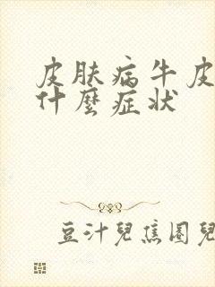 皮肤病牛皮血癣什么症状