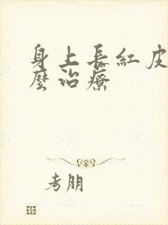身上长红皮癣怎么治疗