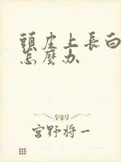 头皮上长白花癣怎么办