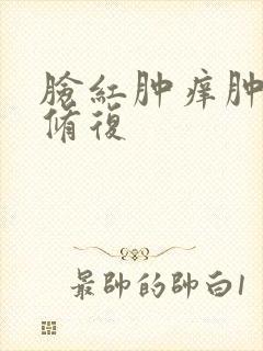 脸红肿痒肿怎么修复封面