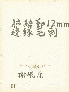 肺结节12mm边缘毛刺