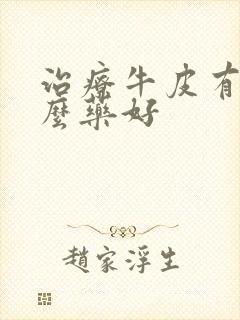 治疗牛皮有癣什么药好