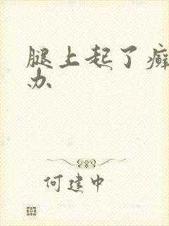 腿上起了癣怎么办