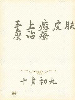 手上癣皮肤病怎么治疗